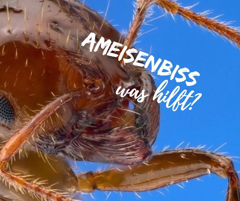 Ameisenbiss – was hilft, wenn man gebissen wurde?